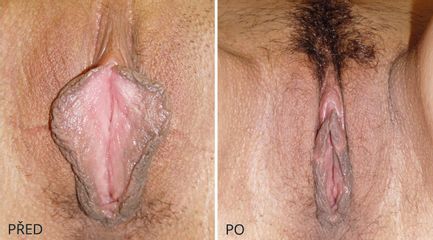 LABIO 2629