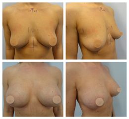 MUDr. Ivo Menšík, Ph.D. - BODY klinika plastické chirurgie