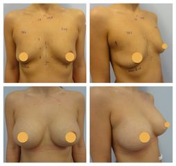 MUDr. Ivo Menšík, Ph.D. - BODY klinika plastické chirurgie