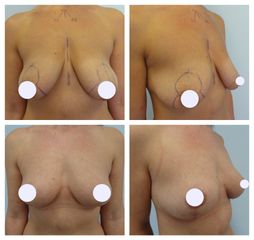 MUDr. Ivo Menšík, Ph.D. - BODY klinika plastické chirurgie