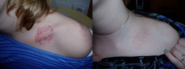 před1