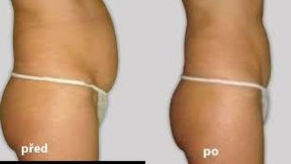 před
