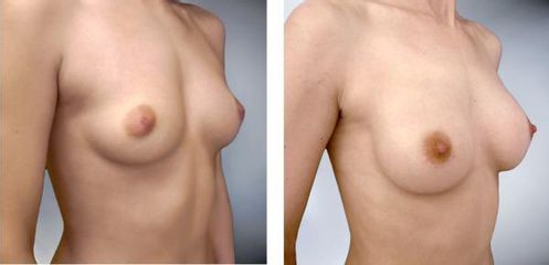 augment5