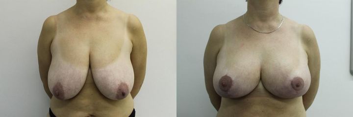 MODELACE KEMPNY před