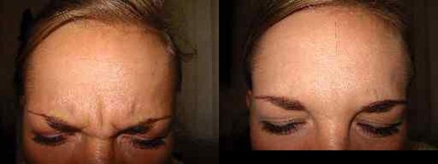 ivyp4pred