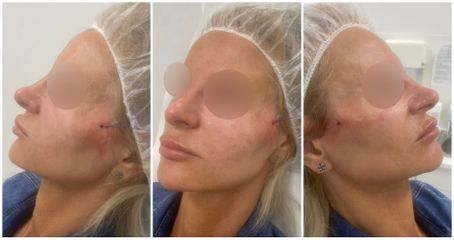 MUDr. Helena Zdobinská Reisingerová - Dermatým