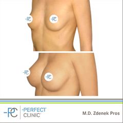 MUDr. Zdeněk Pros - Perfect Clinic