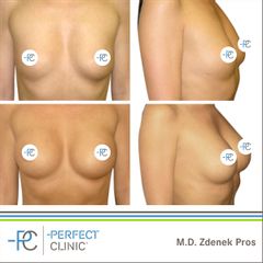 MUDr. Zdeněk Pros - Perfect Clinic
