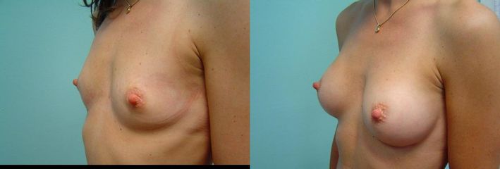 DSC09690