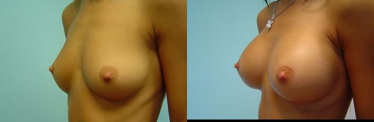 DSC07983