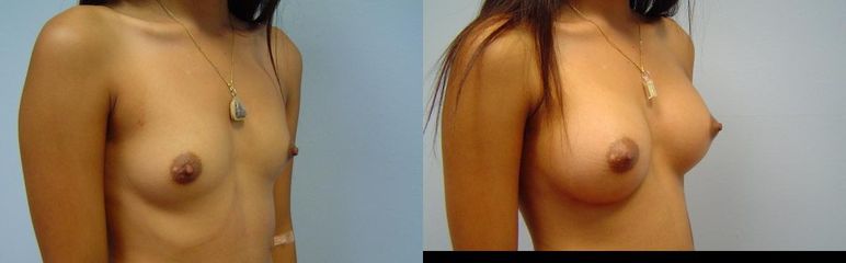 DSC04799