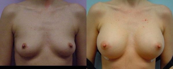 DSC05961