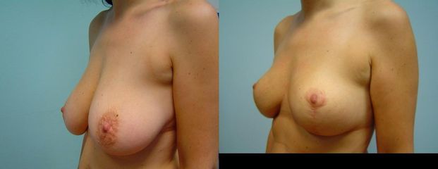 DSC02302