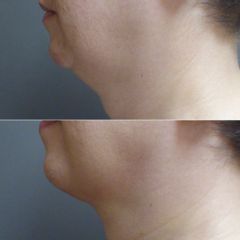 MUDr. Kamila Šormová před  OP2 - 2T poop.2