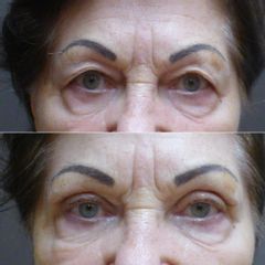 MUDr. Kamila Šormová před OP  - 1M poop.