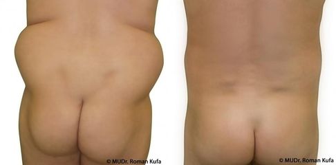 1a