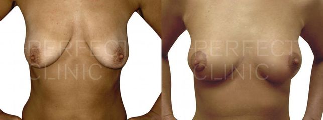 modelace2