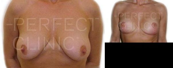 modelace3a