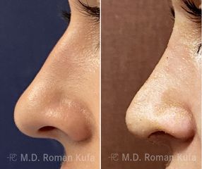 MUDr. Roman Kufa - Perfect Clinic