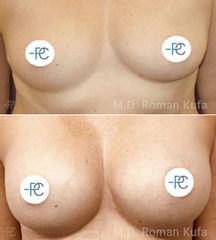 MUDr. Roman Kufa - Perfect Clinic