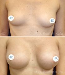 MUDr. Roman Kufa - Perfect Clinic