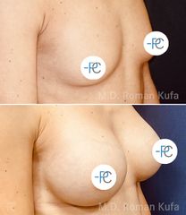 MUDr. Roman Kufa - Perfect Clinic