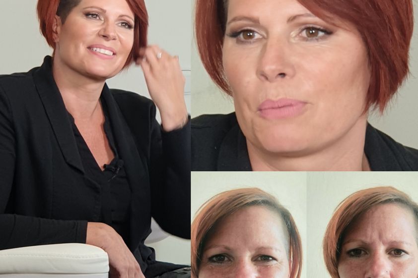 Antiaging před a po - 739860