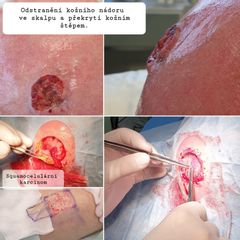 Odstranění nádoru a překrytí kožním stěpem - prim. MUDr. Veliký