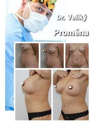 Zvětšení prsou - Plastická a estetická chirurgie Poděbrady - prim. MUDr. Veliký
