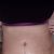 Abdominoplastika+sešité svaly a liposukce vnitřní stehna