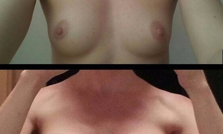 85622