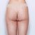 Liposukce BodyTite - MUDr. Helena Singerová, Asklepion