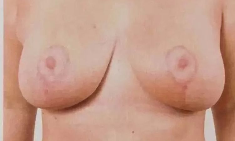 86520