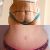 Abdominoplastika, nikdy nebudu litovat