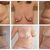 Abdominoplastika a mamoplastika