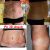 Lipoabdominoplastika ve 48 letech
