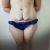 Abdominoplastika a změna života
