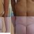 Lower body lift - Abdominoplastika