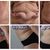 Díky abdominoplastice mám o 2 konfekční čísla méně