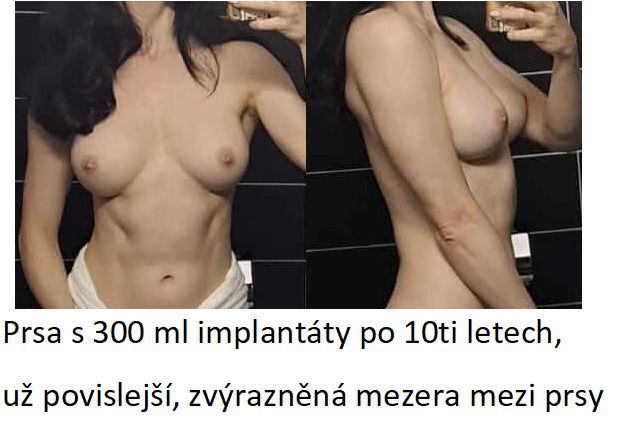 151851