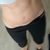 46 let, miniabdominoplastika, velká spokojenost