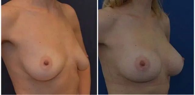 20494