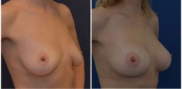 20494