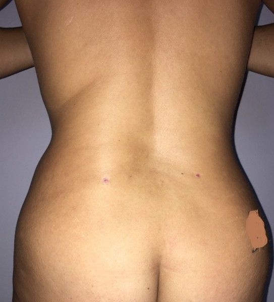 19015