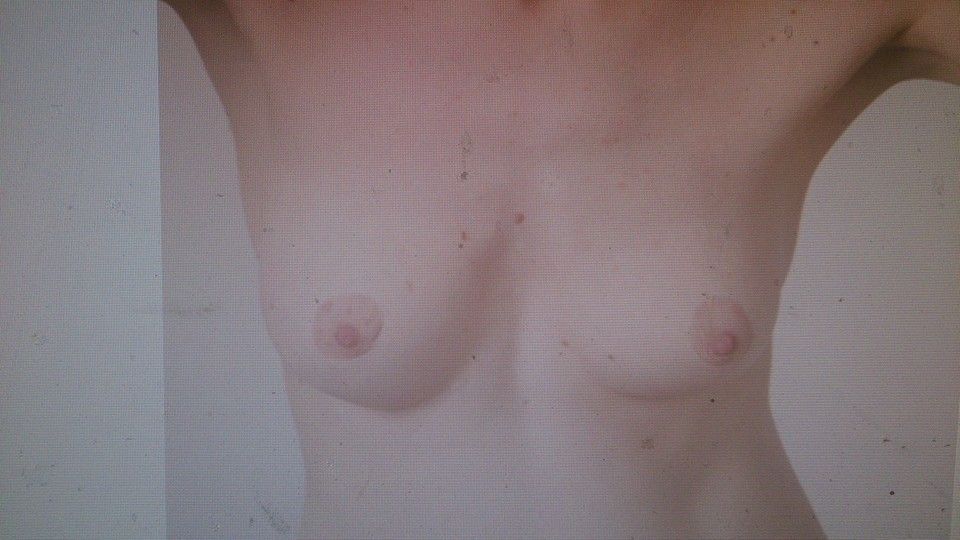 18624