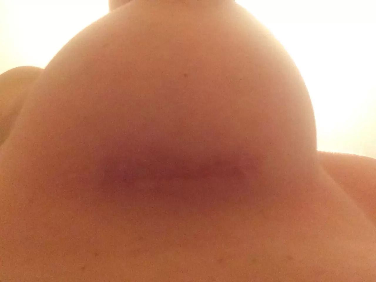 20194