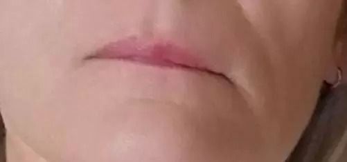 20310