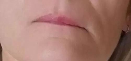 20310