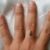 Odstranění tetování z prstu Praha