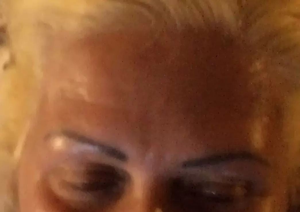 20281